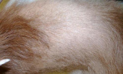 Color Dilution Alopecia