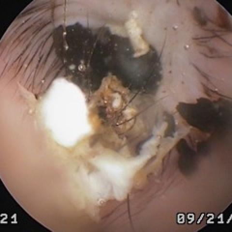 Pet Ostoscope Before